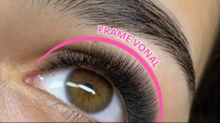 7.2) FRAME VONAL
